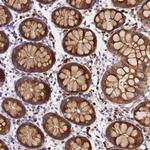 POM121 Polyclonal Antibody