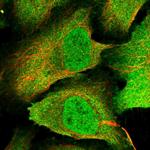 PPP4C Polyclonal Antibody