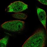 COL28A1 Polyclonal Antibody