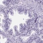 CUBN Antibody in Immunohistochemistry (Paraffin) (IHC (P))