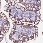 CUBN Antibody in Immunohistochemistry (Paraffin) (IHC (P))