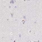 TXNDC6 Antibody in Immunohistochemistry (Paraffin) (IHC (P))