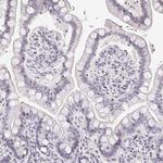 TXNDC6 Antibody in Immunohistochemistry (Paraffin) (IHC (P))