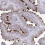 TXNDC6 Antibody in Immunohistochemistry (Paraffin) (IHC (P))