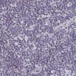 TXNDC6 Antibody in Immunohistochemistry (Paraffin) (IHC (P))