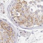 TXNDC6 Antibody in Immunohistochemistry (Paraffin) (IHC (P))