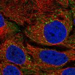 STAM Polyclonal Antibody