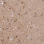STAM Antibody in Immunohistochemistry (Paraffin) (IHC (P))