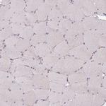 STAM Antibody in Immunohistochemistry (Paraffin) (IHC (P))