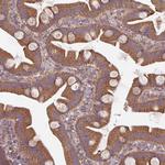 STAM Antibody in Immunohistochemistry (Paraffin) (IHC (P))