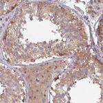 STAM Antibody in Immunohistochemistry (Paraffin) (IHC (P))