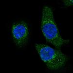HADH Polyclonal Antibody