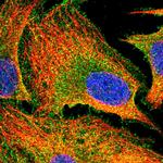 PACSIN3 Polyclonal Antibody