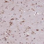 PACSIN3 Antibody in Immunohistochemistry (Paraffin) (IHC (P))