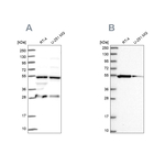 PACSIN3 Antibody in Western Blot (WB)