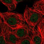 PLCB3 Polyclonal Antibody