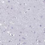 PLCB3 Antibody in Immunohistochemistry (Paraffin) (IHC (P))