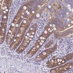 PLCB3 Antibody in Immunohistochemistry (Paraffin) (IHC (P))