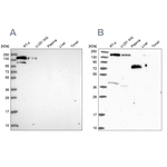 PLCB3 Antibody in Western Blot (WB)