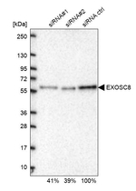 EXOSC8 Antibody in Western Blot (WB)