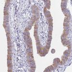 SUGT1 Antibody in Immunohistochemistry (Paraffin) (IHC (P))
