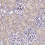 SUGT1 Antibody in Immunohistochemistry (Paraffin) (IHC (P))