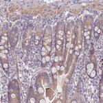 SUGT1 Antibody in Immunohistochemistry (Paraffin) (IHC (P))