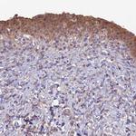 GIPC1 Polyclonal Antibody