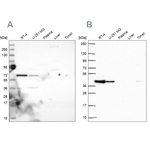 GIPC1 Antibody in Western Blot (WB)