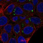 FAM149A Antibody in Immunocytochemistry (ICC/IF)