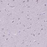 KRT73 Antibody in Immunohistochemistry (Paraffin) (IHC (P))