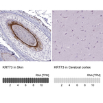 KRT73 Polyclonal Antibody