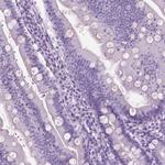 KRT73 Antibody in Immunohistochemistry (Paraffin) (IHC (P))