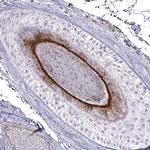 KRT73 Antibody in Immunohistochemistry (Paraffin) (IHC (P))