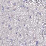 STIP1 Antibody in Immunohistochemistry (Paraffin) (IHC (P))
