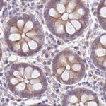 STIP1 Antibody in Immunohistochemistry (Paraffin) (IHC (P))