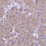 STIP1 Antibody in Immunohistochemistry (Paraffin) (IHC (P))