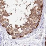 STIP1 Antibody in Immunohistochemistry (Paraffin) (IHC (P))