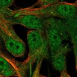 CRALBP Polyclonal Antibody