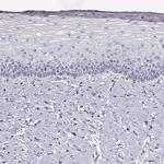 CRALBP Antibody in Immunohistochemistry (Paraffin) (IHC (P))