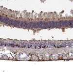 CRALBP Antibody in Immunohistochemistry (Paraffin) (IHC (P))
