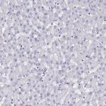 CRALBP Antibody in Immunohistochemistry (Paraffin) (IHC (P))