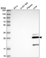 CCS Antibody in Western Blot (WB)