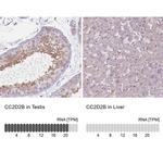 CC2D2B Antibody