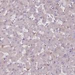 CC2D2B Polyclonal Antibody