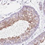 CC2D2B Antibody in Immunohistochemistry (Paraffin) (IHC (P))