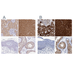 FAH Polyclonal Antibody