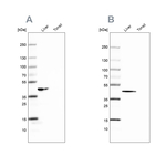 FAH Antibody in Western Blot (WB)