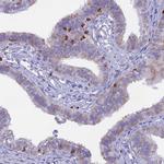 ABI3BP Antibody in Immunohistochemistry (Paraffin) (IHC (P))