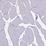 ABI3BP Antibody in Immunohistochemistry (Paraffin) (IHC (P))